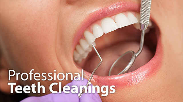 Professional Teeth Cleanings Video Professional Teeth Cleanings Video